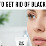 How to Get Rid of Blackheads: Real Solutions That Actually Work